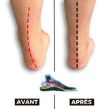 Semelles Orthopédiques contre les Douleurs Plantaires