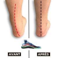 Semelles Orthopédique Douleur Plantaire