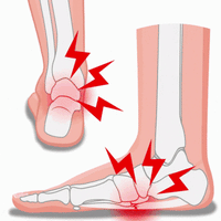 Semelles Orthopédique Douleur Plantaire