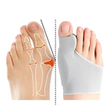 Coffret Hallux Valgus "Prévention & Marche Saine"